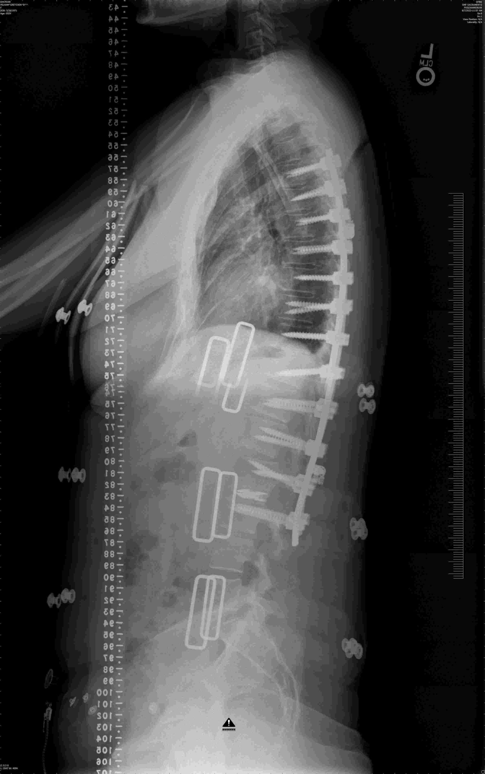 xray image of spine